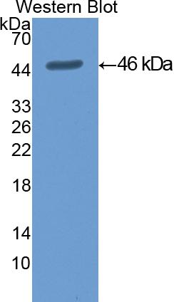 Cytokeratin 19 (CK19) Polyclonal Antibody - image 2