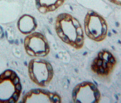 Cytokeratin 19 (CK19) Polyclonal Antibody - image 3