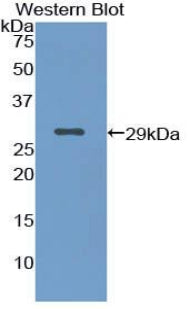 Knockout Varification: <br/>Lane 1: Wild-type Hela cell lysate; <br/>Lane 2: KRT18 knockout Hela cell lysate; <br/>Predicted MW: 48kDa <br/>Observed MW: 48kDa<br/>Primary Ab: 2µg/ml Rabbit Anti-Human KRT18 Antibody<br/>Second Ab: 0.2µg/mL HRP-Linked Caprine Anti-Rabbit IgG Polyclonal Antibody<br/>