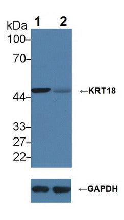 DAB staining on IHC-P; Samples: Human Stomach Tissue; Primary Ab: 20µg/ml Rabbit Anti-Human KRT18 Antibody Second Ab: 2µg/mL HRP-Linked Caprine Anti-Rabbit IgG Polyclonal Antibody