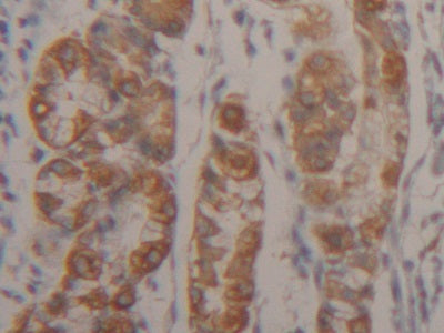 DAB staining on fromalin fixed paraffin-embedded Kidney tissue)