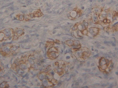 Cytokeratin 18 (CK18) Polyclonal Antibody - image 5