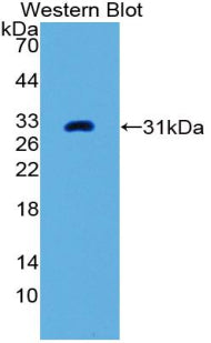 Used in DAB staining on fromalin fixed paraffin- embedded Kidney tissue