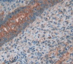 Alkaline Phosphatase, Placental (ALPP) Polyclonal Antibody - image 4
