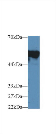 Western Blot; Sample: Recombinant protein.