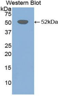 DAB staining on IHC-P; Samples: Mouse Cerebrum Tissue; Primary Ab: 10µg/ml Rabbit Anti-Mouse FGb Antibody Second Ab: 2µg/mL HRP-Linked Caprine Anti-Rabbit IgG Polyclonal Antibody