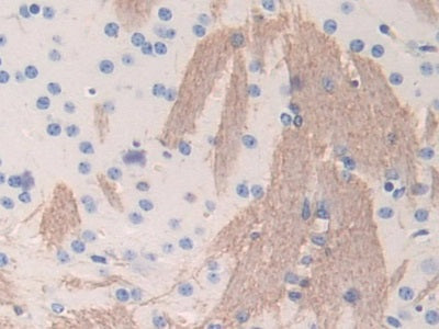 DAB staining on fromalin fixed paraffin-embedded Liver tissue)