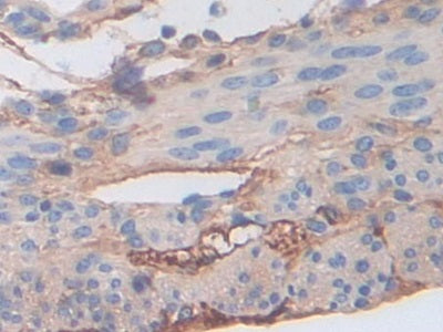 Fibrinogen Beta Chain (FGB) Polyclonal Antibody - image 5