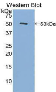 Used in DAB staining on fromalin fixed paraffin-embedded Liver tissue