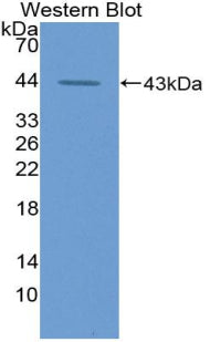 Aspartate Aminotransferase (AST) Polyclonal Antibody - image 2