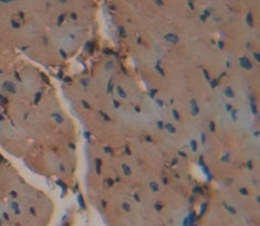 Aspartate Aminotransferase (AST) Polyclonal Antibody - image 3