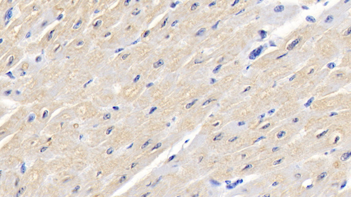 DAB staining on IHC-P; Samples: Bovine Liver Tissue;  Primary Ab: 20μg/ml Rabbit Anti-Bovine AST Antibody Second Ab: 2µg/mL HRP-Linked Caprine Anti-Rabbit IgG Polyclonal Antibody