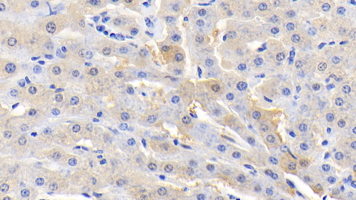 Aspartate Aminotransferase (AST) Polyclonal Antibody - image 5