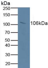 Western Blot; Sample: Recombinant RB1, Human.