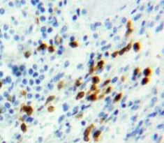 Retinoblastoma Protein 1 (RB1) Polyclonal Antibody - image 4