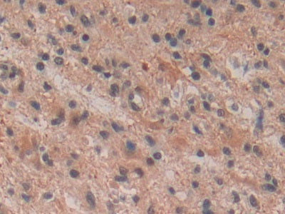 Neurokinin B (NKB) Polyclonal Antibody - image 4
