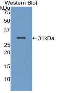 Used in DAB staining on fromalin fixed paraffin-embedded Lung tissue