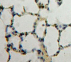 Nucleoporin 88 (NUP88) Polyclonal Antibody - image 4
