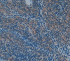 Cartilage Oligomeric Matrix Protein (COMP) Polyclonal Antibody - image 3