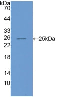 DAB staining on IHC-P; Samples: Mouse Liver Tissue; Primary Ab: 10µg/ml Rabbit Anti-Mouse COMP Antibody Second Ab: 2µg/mL HRP-Linked Caprine Anti-Rabbit IgG Polyclonal Antibody