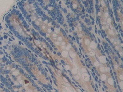 Cartilage Oligomeric Matrix Protein (COMP) Polyclonal Antibody - image 5