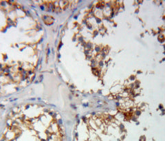 Cartilage Oligomeric Matrix Protein (COMP) Polyclonal Antibody - image 4