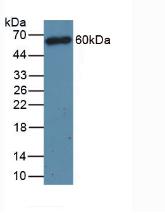 Western Blot; Sample: Recombinant protein.