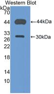 Used in DAB staining on fromalin fixed paraffin-embedded Liver tissue