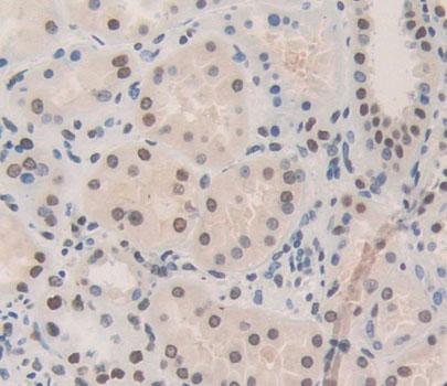 Nucleoporin 133 (NUP133) Polyclonal Antibody - image 4