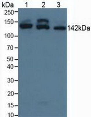 Knockout Varification: ; Lane 1: Wild-type Jurkat cell lysate; ; Lane 2: SMC3 knockout Jurkat cell lysate; ; Predicted MW: 142kd ; Observed MW: 142kd; Primary Ab: 3µg/ml Rabbit Anti-Human SMC3 Antibody; Second Ab: 0.2µg/mL HRP-Linked Caprine Anti-Rabbit IgG Polyclonal Antibody;