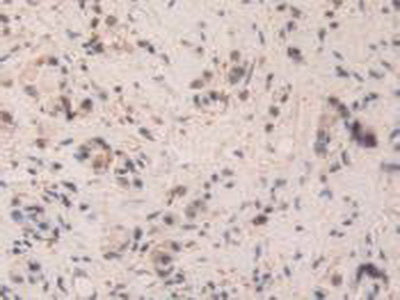 Structural Maintenance Of Chromosomes Protein 3 (SMC3) Polyclonal Antibody - image 5