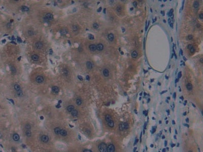 DAB staining on IHC-P; Samples: Human Brain Tissue