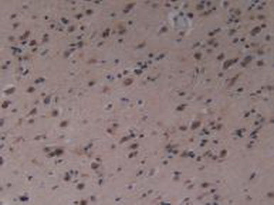 Mitogen Activated Protein Kinase Kinase Kinase 1 (MAP3K1) Polyclonal Antibody - image 4