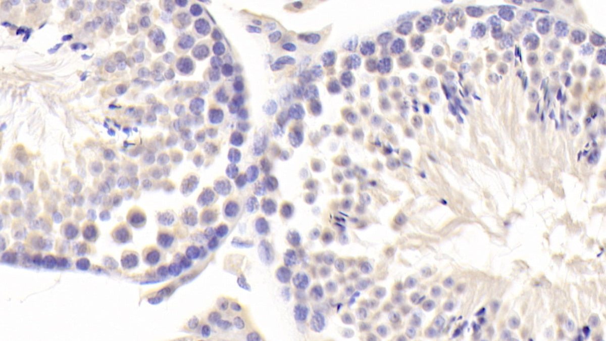Mitogen Activated Protein Kinase Kinase Kinase Kinase 5 (MAP4K5) Polyclonal Antibody - image 3