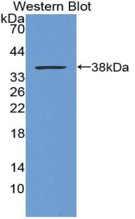 Metallothionein 1 (MT1) Polyclonal Antibody - image 2