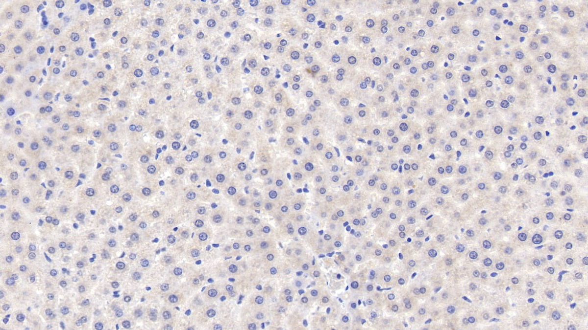 DAB staining on IHC-P; Samples: Rat Colon Tissue;  Primary Ab: 30µg/ml Rabbit Anti-Rat MT1 Antibody Second Ab: 2µg/mL HRP-Linked Caprine Anti-Rabbit IgG Polyclonal Antibody