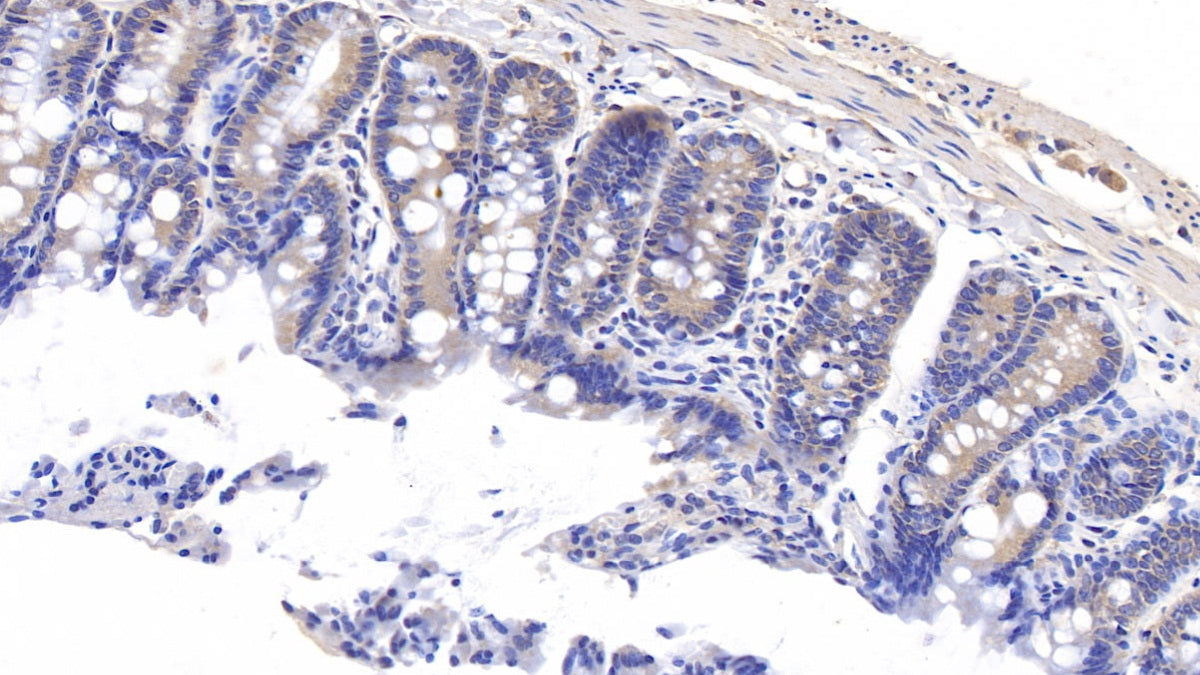 Metallothionein 1 (MT1) Polyclonal Antibody - image 4