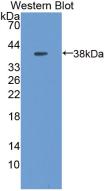 Metallothionein 1 (MT1) Polyclonal Antibody - image 2