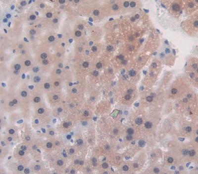 Metallothionein 1 (MT1) Polyclonal Antibody - image 3