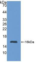 Metallothionein 1 (MT1) Polyclonal Antibody - image 2