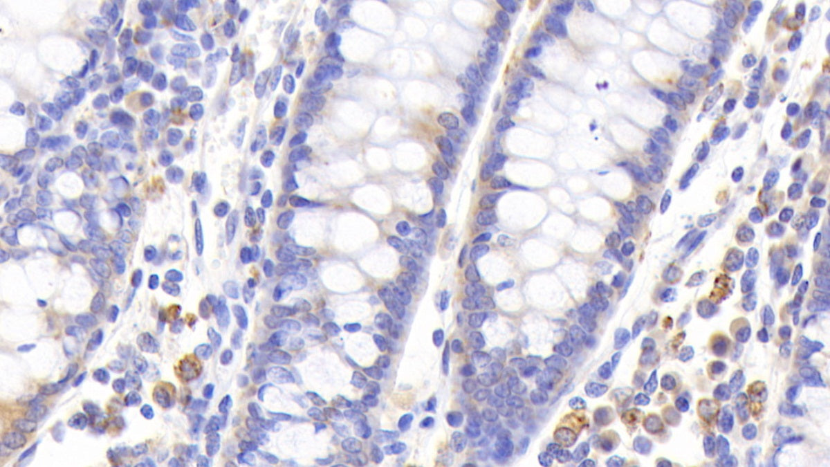 Metallothionein 1 (MT1) Polyclonal Antibody - image 3