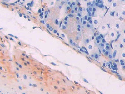 DAB staining on IHC-P; Samples: Mouse Uterus Tissue