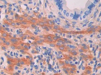 Myosin Light Chain Kinase (MYLK) Polyclonal Antibody - image 4