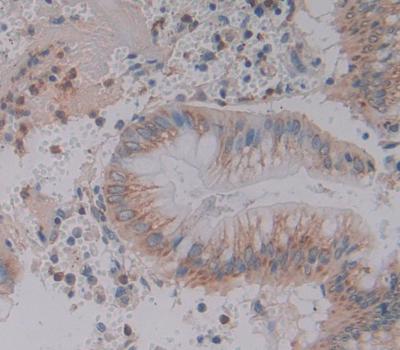 Motility Related Protein (MRP1) Polyclonal Antibody - image 3