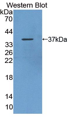 Alkaline Phosphatase, Tissue-nonspecific (ALPL) Polyclonal Antibody - image 2