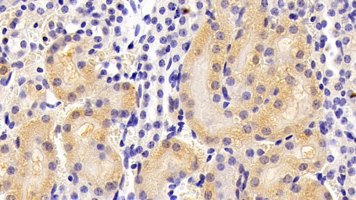 Alkaline Phosphatase, Tissue-nonspecific (ALPL) Polyclonal Antibody - image 4