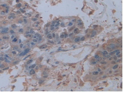 Alkaline Phosphatase, Tissue-nonspecific (ALPL) Polyclonal Antibody - image 5