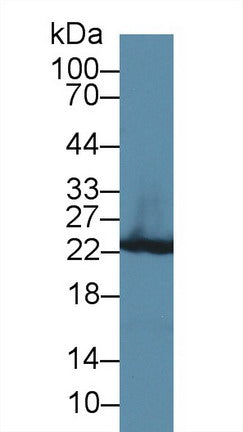 Western Blot; Sample: Rat Serum; Primary Ab: 3µg/ml Rabbit Anti-Rat GSTp Antibody Second Ab: 0.2µg/mL HRP-Linked Caprine Anti-Rabbit IgG Polyclonal Antibody