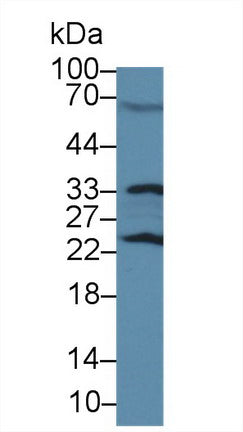 DAB staining on IHC-P; Samples: Rat Testis Tissue; Primary Ab: 10µg/ml Rabbit Anti-Rat GSTp Antibody Second Ab: 2µg/mL HRP-Linked Caprine Anti-Rabbit IgG Polyclonal Antibody