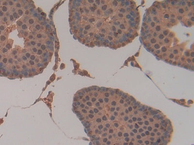 DAB staining on IHC-P; Samples: Rat Testis Tissue)